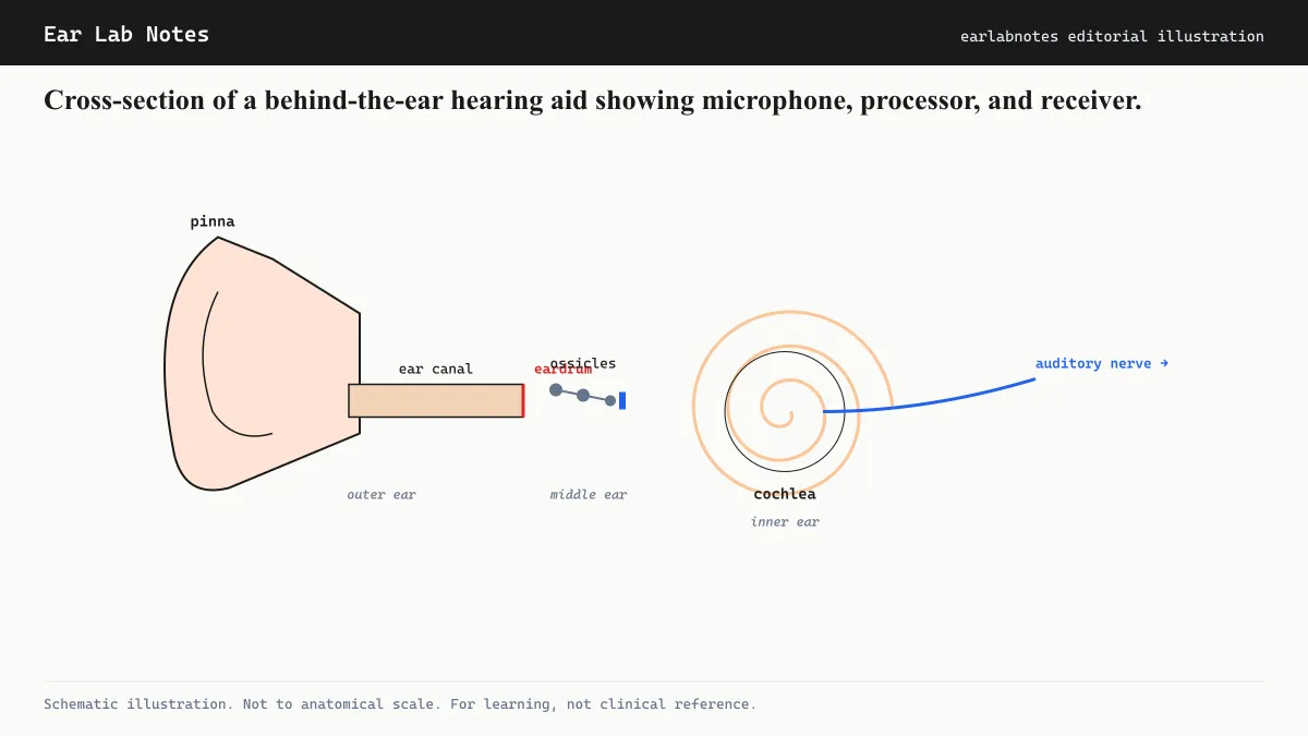 Cross-section of a behind-the-ear hearing aid showing microphone, processor, and receiver.