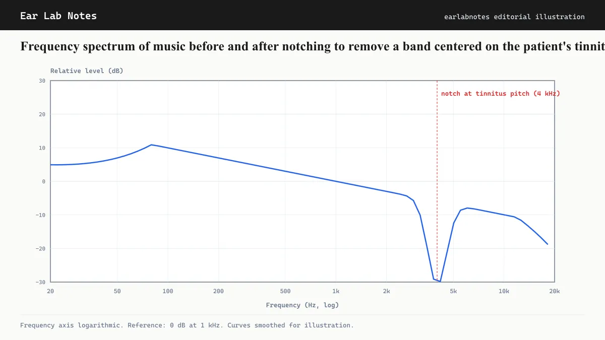 Frequency spectrum of music before and after notching to remove a band centered on the patient's tinnitus pitch.