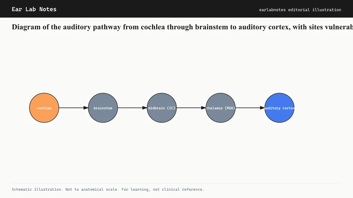 Diagram of the auditory pathway from cochlea through brainstem to auditory cortex, with sites vulnerable to TBI marked.