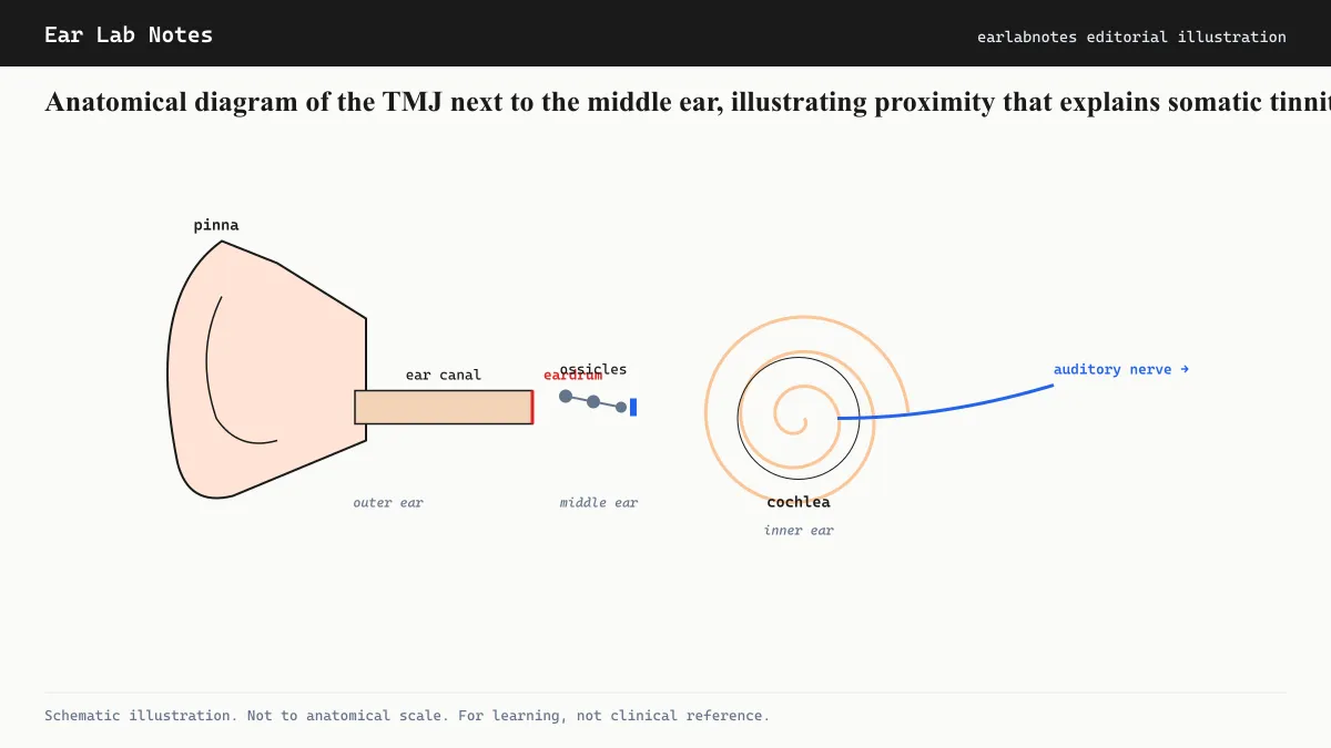 Anatomical diagram of the TMJ next to the middle ear, illustrating proximity that explains somatic tinnitus.